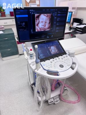 Inovácia v obraze a bezkonkurenčné vyšetrenie: Šačianska Gynekologicko-pôrodnícka klinika kúpou najmodernejšieho USG prístroja vstúpila do novej éry ultrazvukovej diagnostiky 